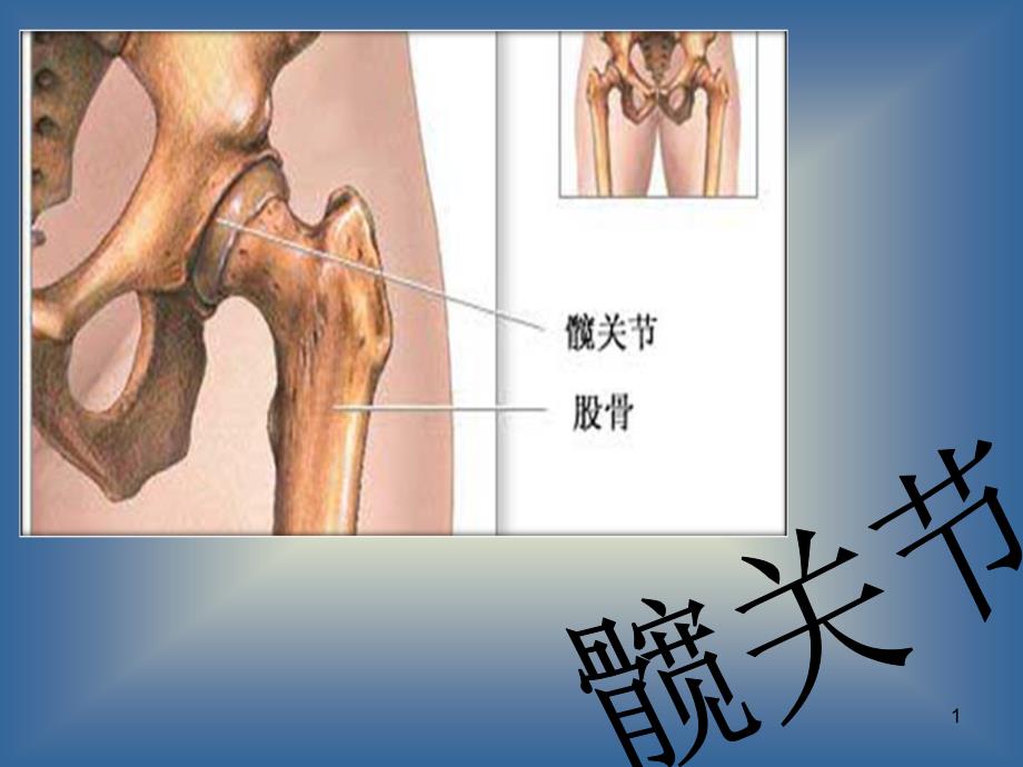 髋关节及其常见病课件_第1页