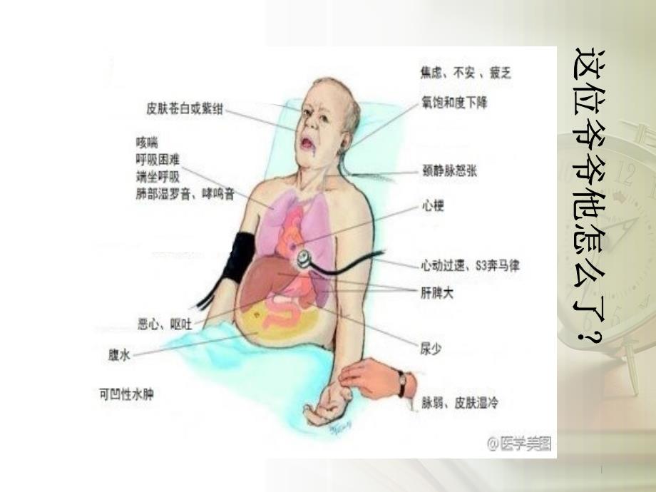 心力衰竭的护理教学查房课件_第1页