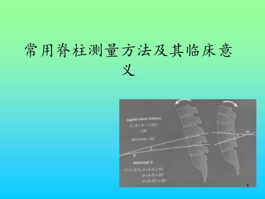 常用脊柱测量方法及其临床意义-课件_第1页