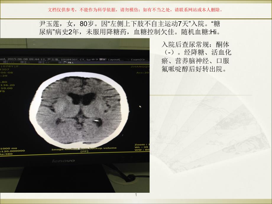 偏侧舞蹈症专题讲座ppt课件_第1页