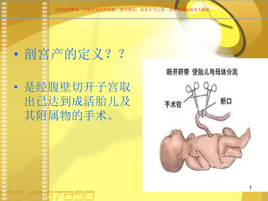 剖宫产医学知识ppt课件_第1页