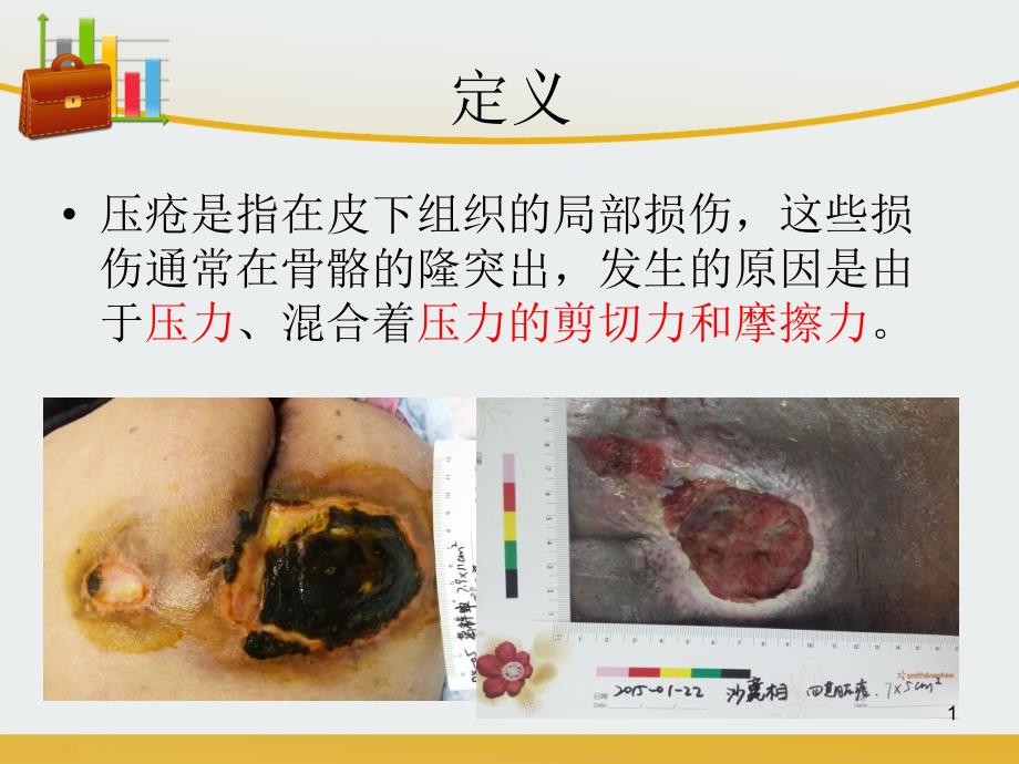 医学ppt课件压疮上报和处置_第1页