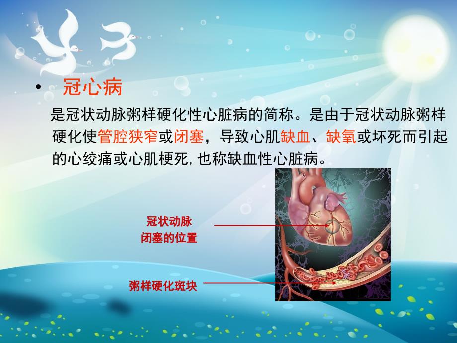 心肌梗死健康宣教ppt课件_第1页