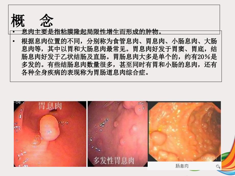 胃肠息肉摘除术课件_第1页