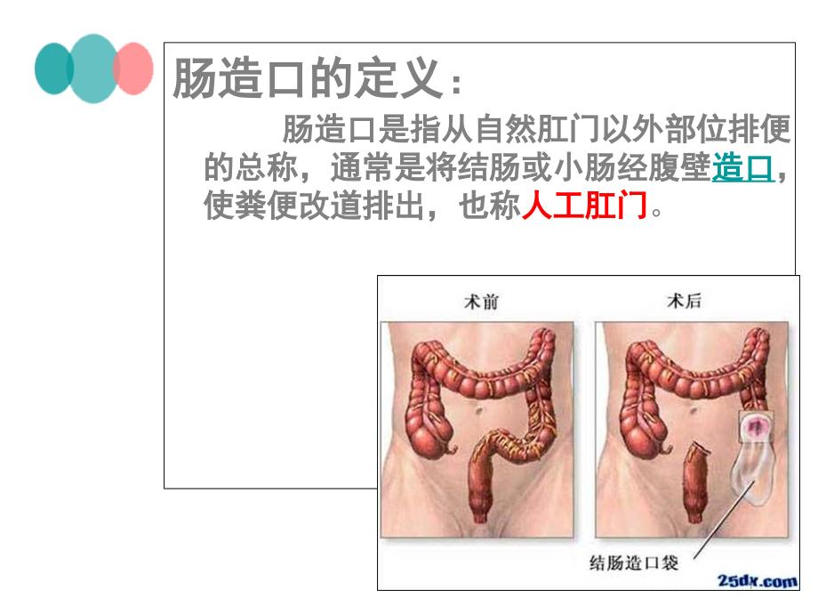 造瘘口的护理课件_第1页