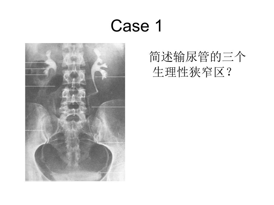 泌尿系常见病多发病课件_第1页