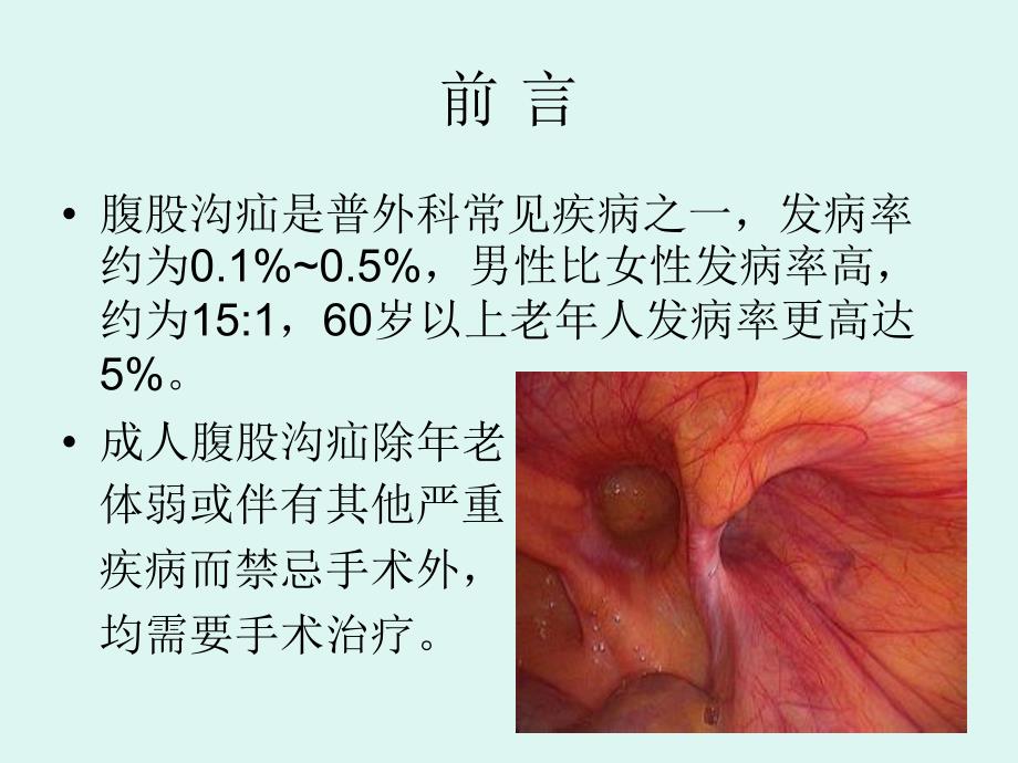 完全腹膜外补片植入术_第1页