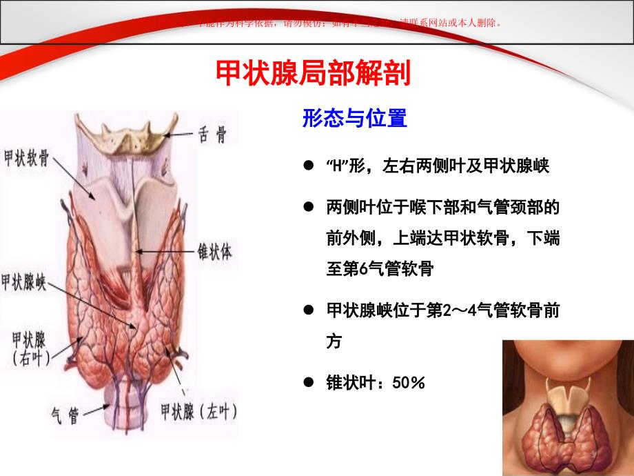 甲状腺部分切除术手术配合ppt课件_第1页