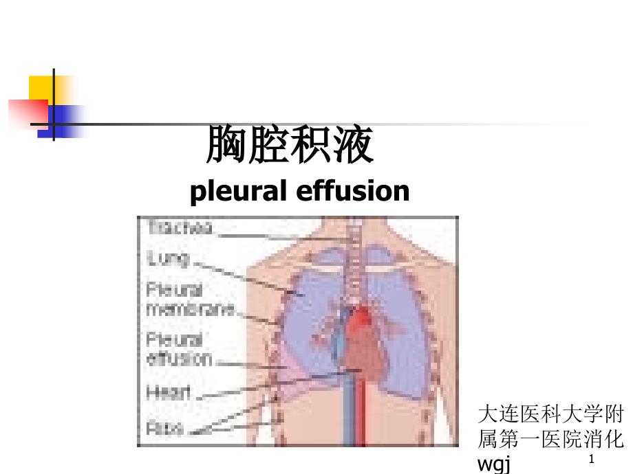 胸腔积液ppt课件_第1页