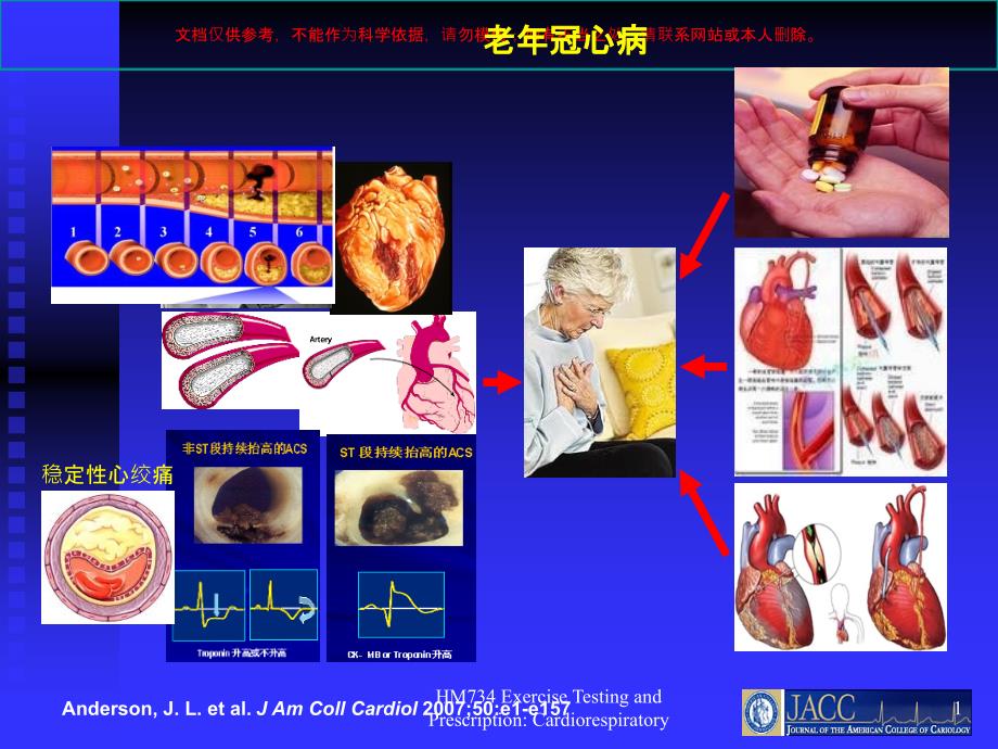 老年冠心病患者心脏康复治疗的基本概念ppt课件_第1页