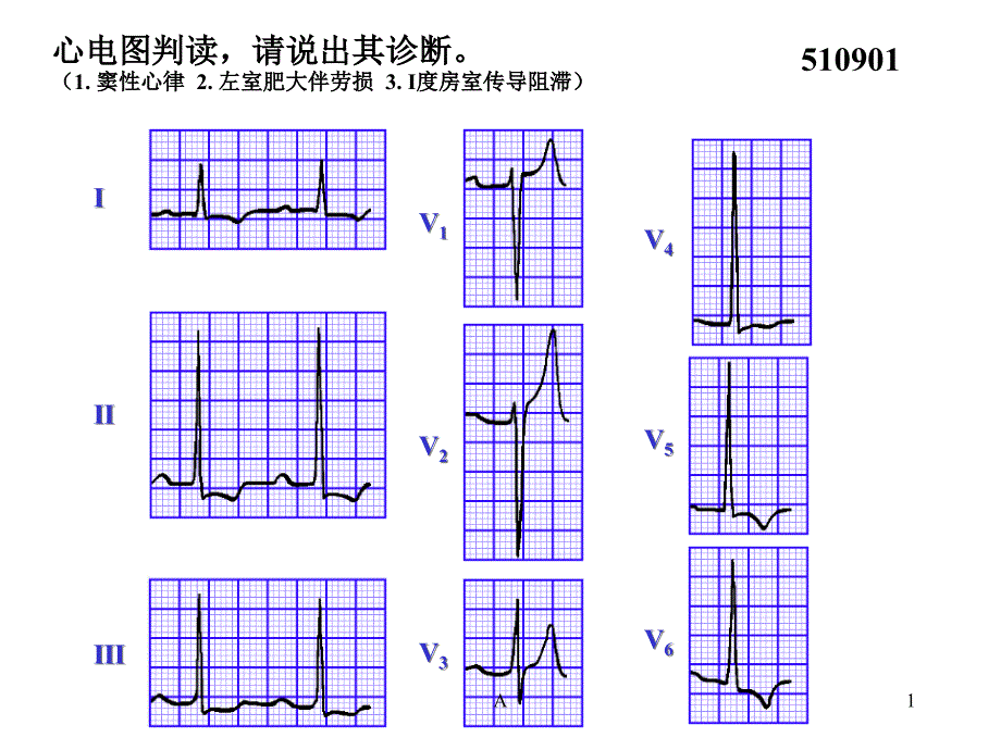 心电图试题及答案课件_第1页