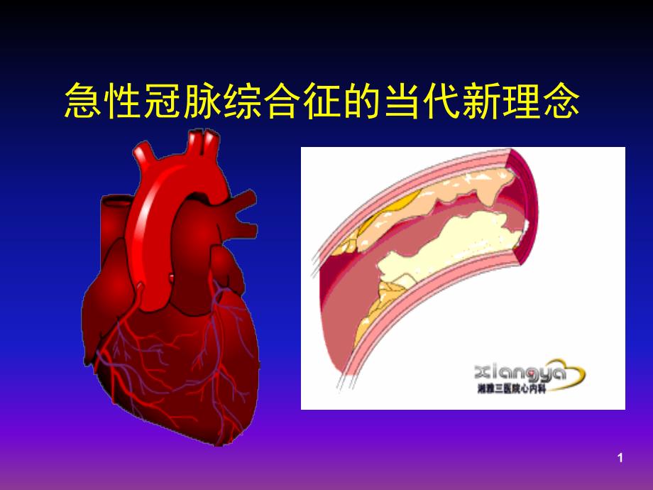 急性冠脉综合征的当代新理念(讲稿)课件_第1页