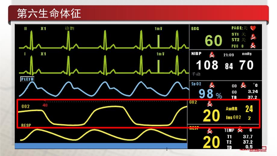 医学呼气末二氧化碳在急诊的临床应用课件_第1页