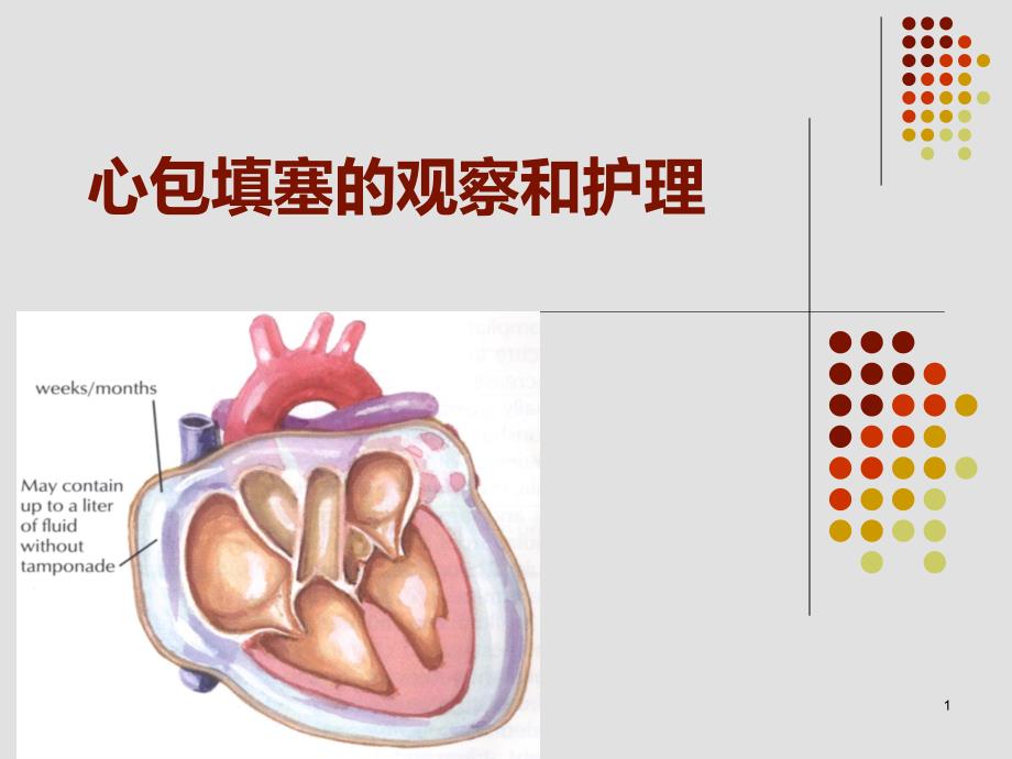 心包填塞和心包引流的护理课件_第1页