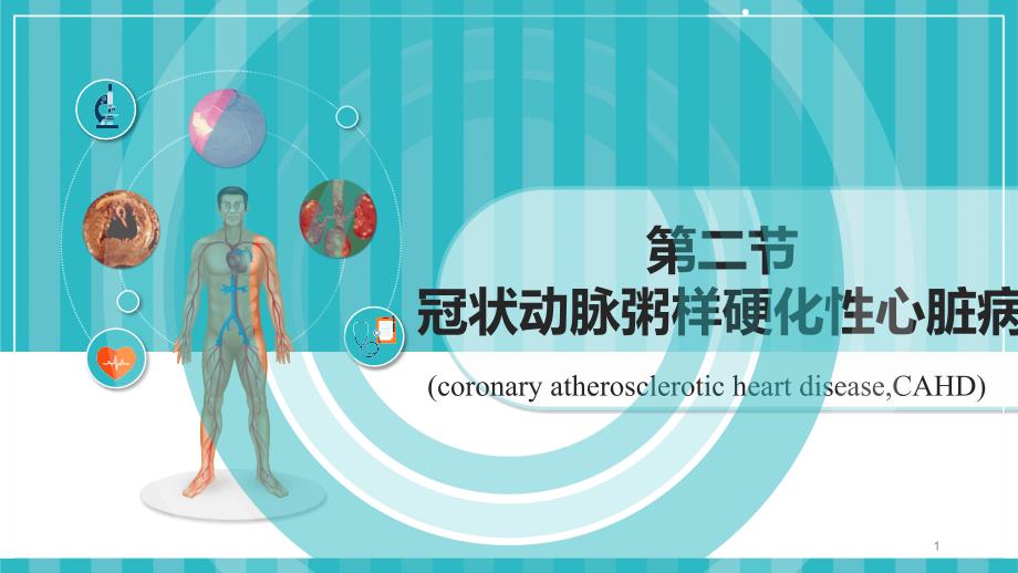 冠状动脉粥样硬化性心脏课件_第1页