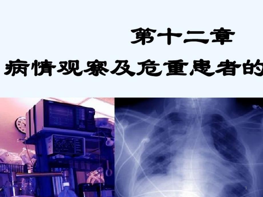 2021年病情观察及危重患者支持性护理课件_第1页