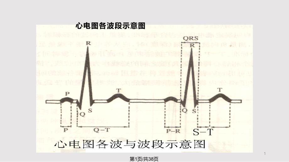 常见心电图分析课件_第1页