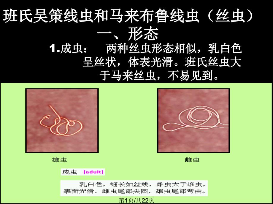 班氏吴策线虫和马来布鲁线虫_第1页