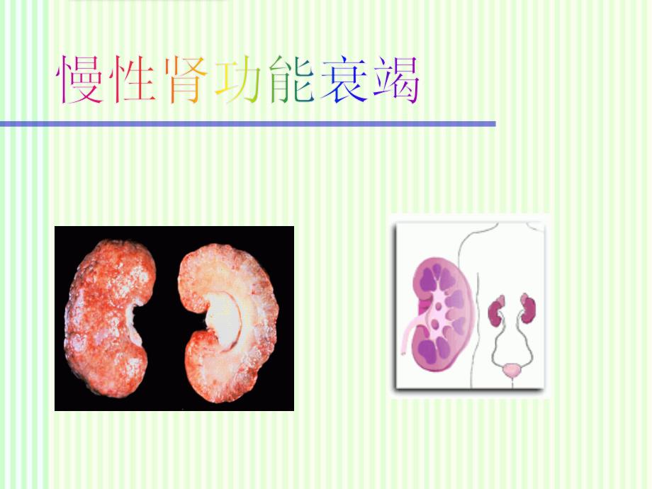 内科学：慢性肾功能衰竭课件_第1页