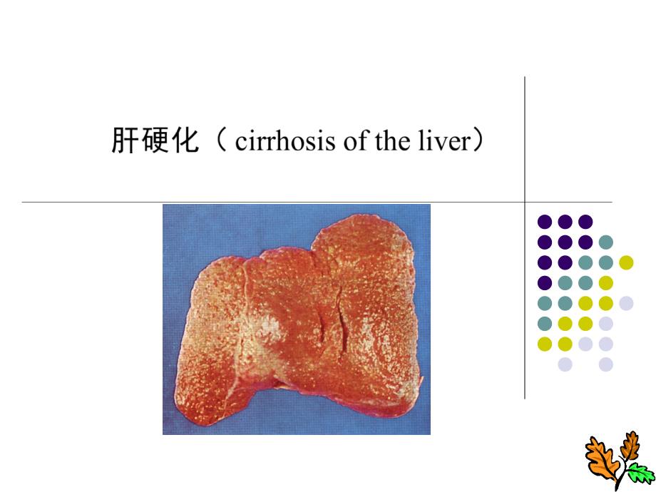 病理学肝硬化课件_第1页