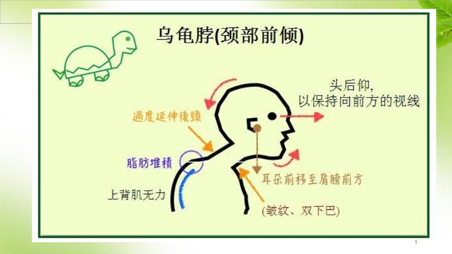 深度分析乌龟脖颈椎病运动康复ppt课件_第1页