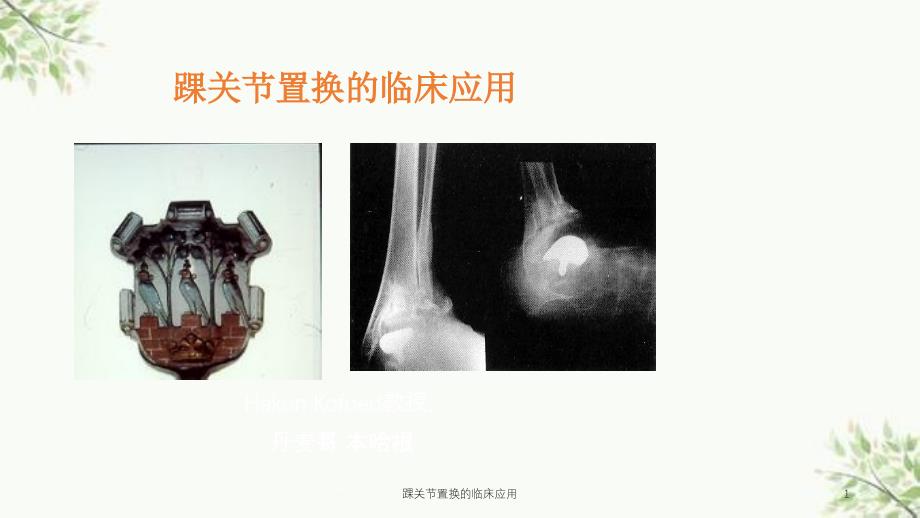 踝关节置换的临床应用ppt课件_第1页