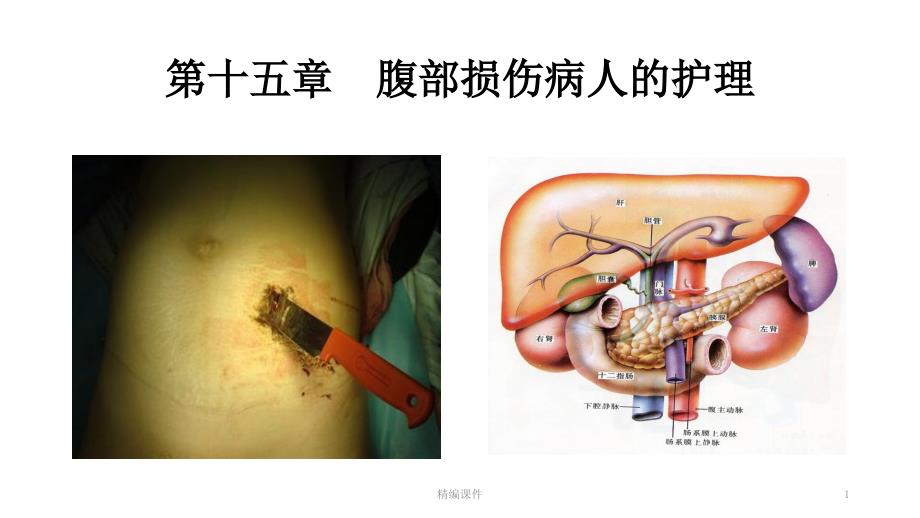 腹部损伤病人的护理【培训学习】课件_第1页