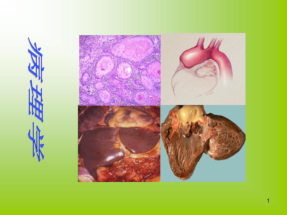 病理学第一章绪论课件_第1页
