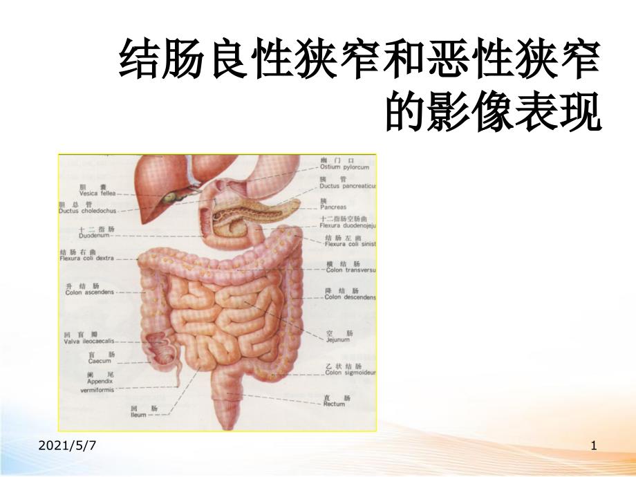 结肠良性狭窄和恶性狭窄的影像表现课件_第1页