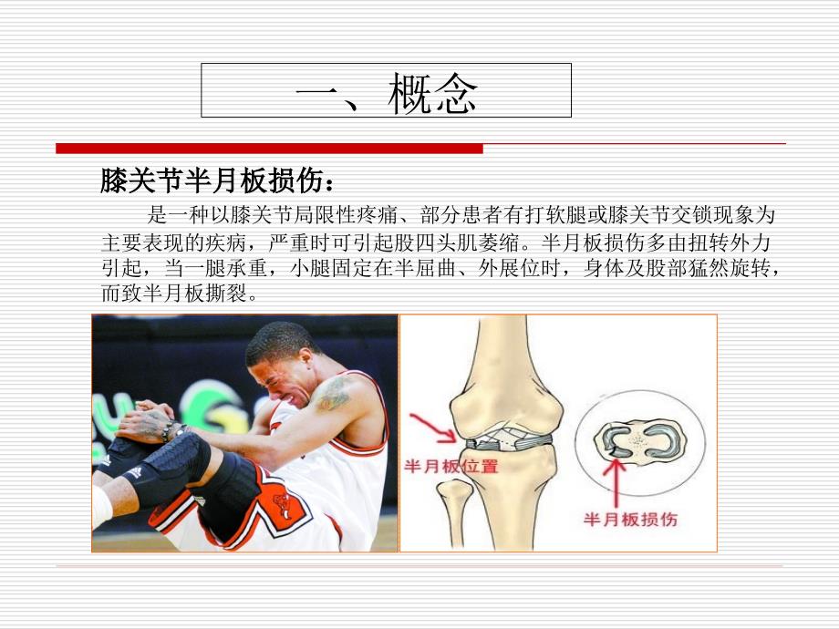 膝关节半月板损伤修改课件_第1页