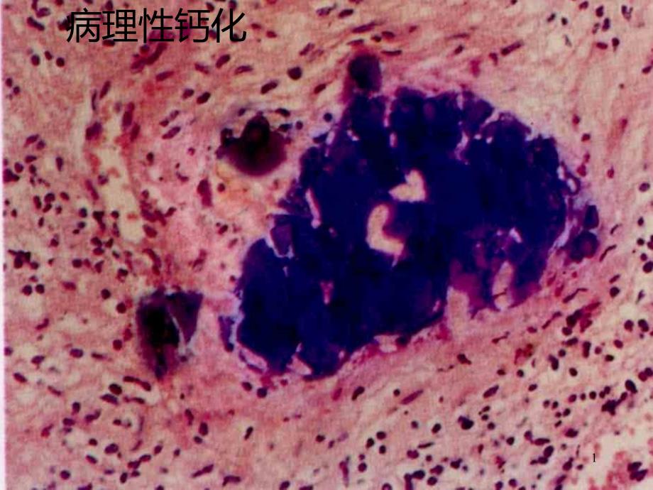 病理学图片 ppt课件_第1页