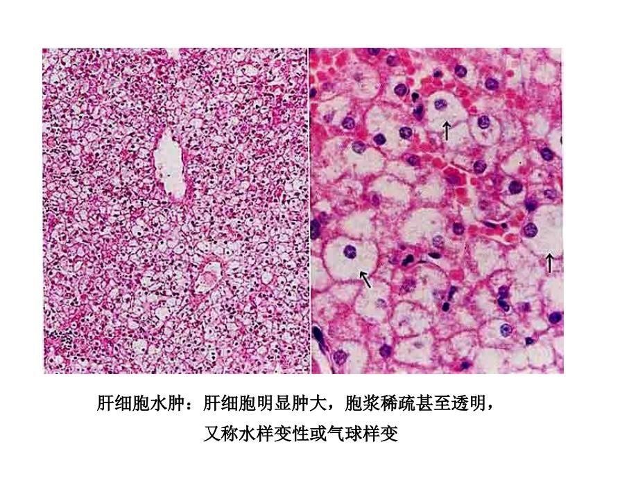 病理图片描述课件_第1页