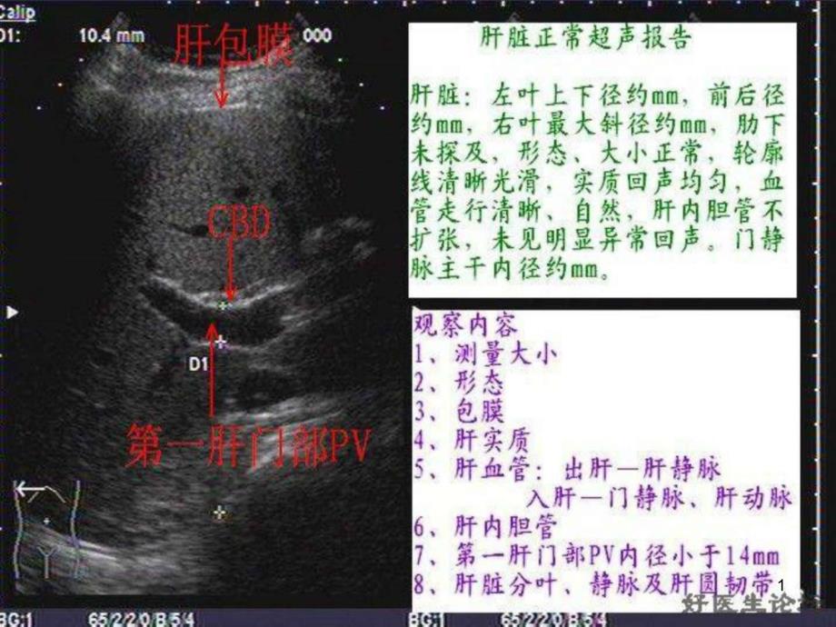 肝脏切面药学医药卫生专业课件_第1页