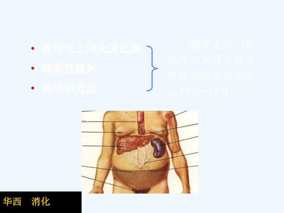 生物医学肝硬化门脉高压的介入治疗课件_第1页