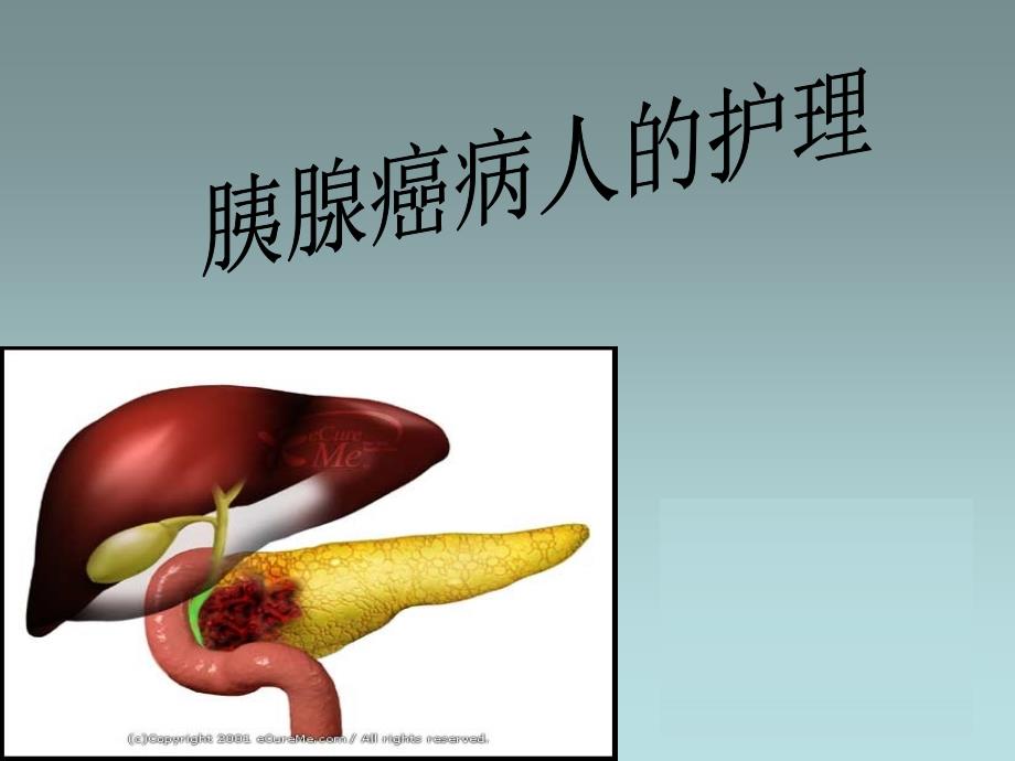 胰腺癌病人的护理课件_第1页