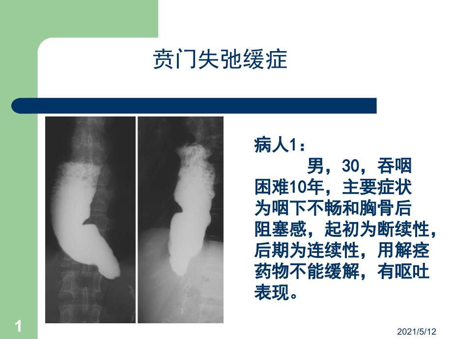 消化系统影像诊断学ppt课件_第1页