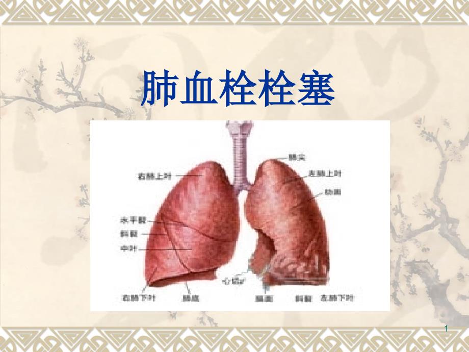 肺栓塞讲课教学课件_第1页