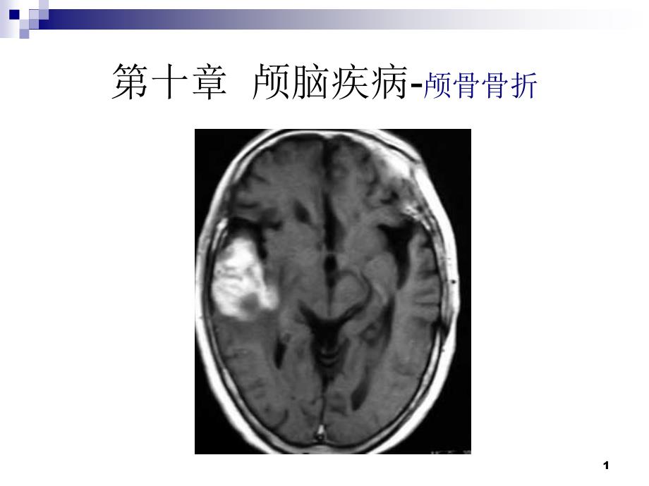 颅脑疾病课件_第1页