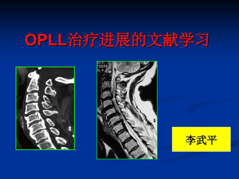 OPLL治疗进展的文献学习_第1页