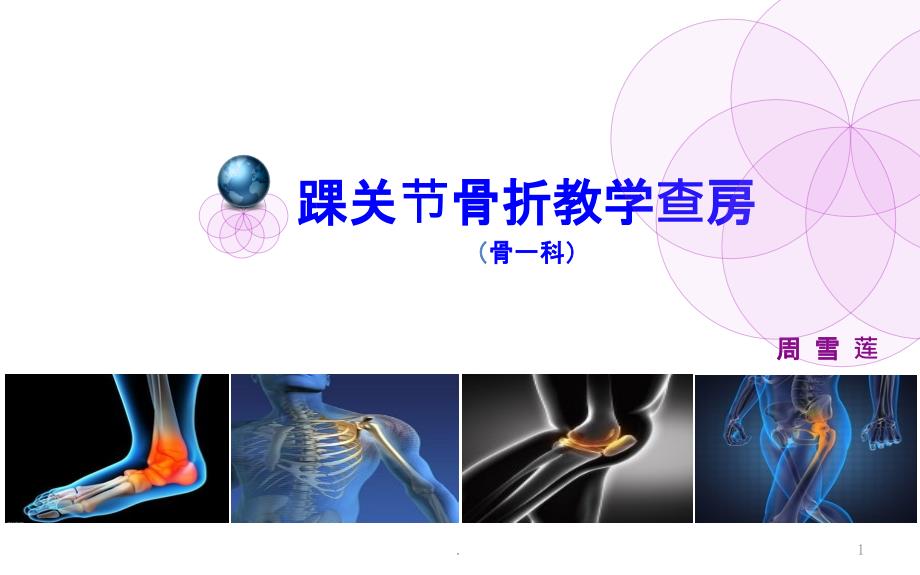 踝关节骨折课件_第1页