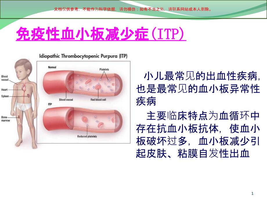 儿童免疫性血小板减少症的诊治ppt课件_第1页