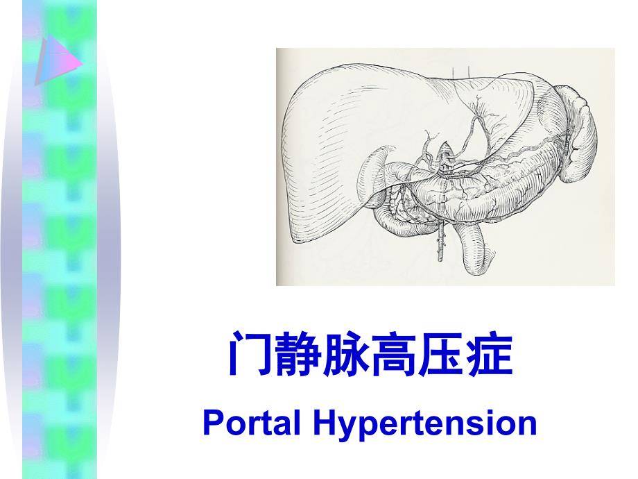 门静脉高压症(英文)课件_第1页