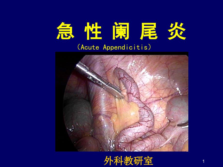 急性阑尾炎外科治疗课件_第1页