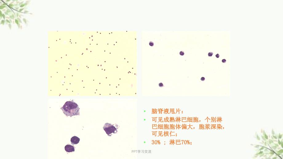 化脓性脑膜脑炎课件_第1页