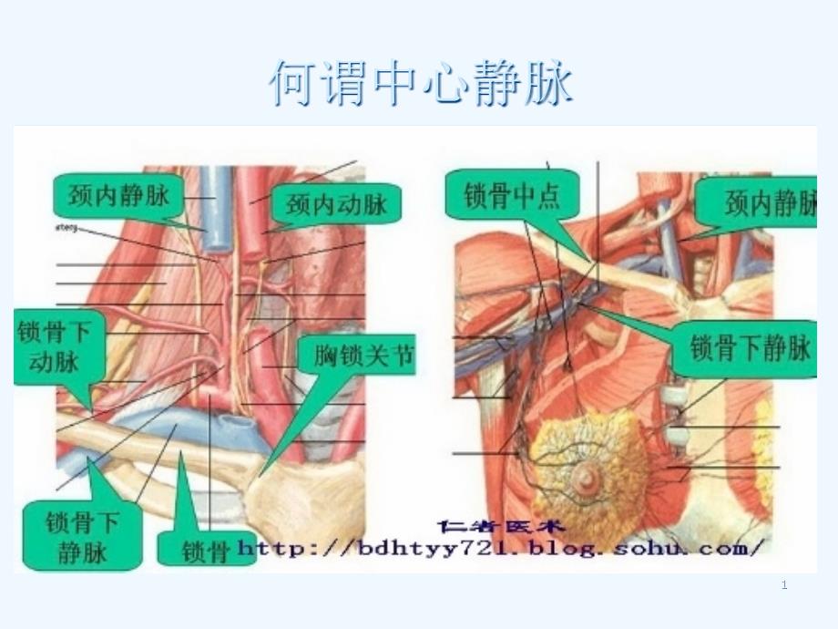 中心静脉置管及护理课件_第1页