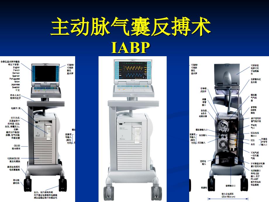 主动脉球囊反博(培训类)课件_第1页