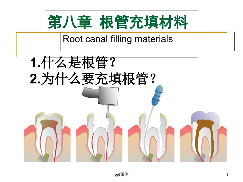 第八章-根管充填材料课件_第1页