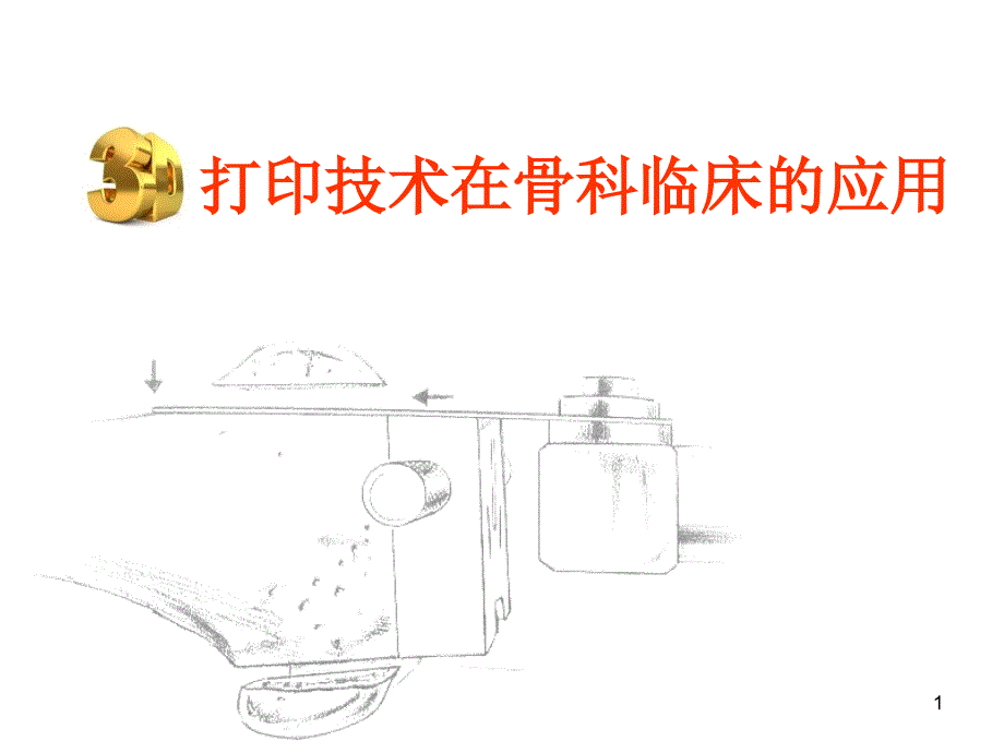 3D打印技术在骨科临床的应用课件_第1页