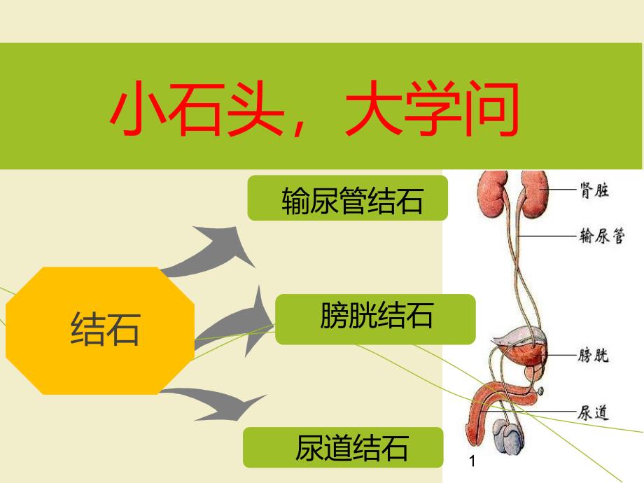 结石疾病培训课件_第1页