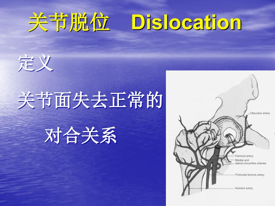 关节脱位dislocation课件_第1页